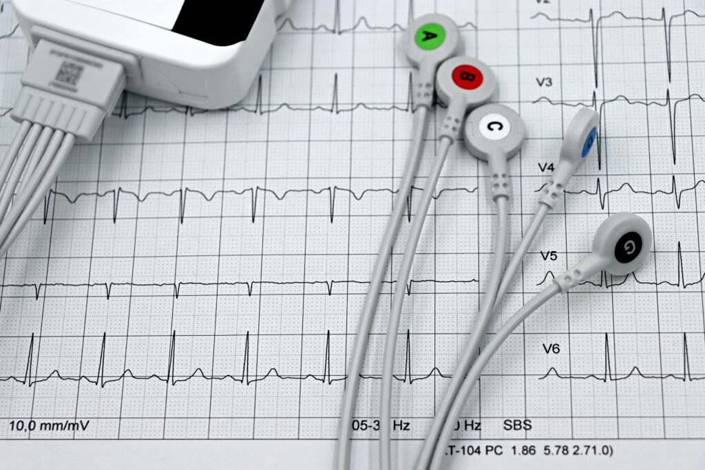 Close-up of ECG monitor leads on a printed cardiogram, showcasing heart health diagnostics.